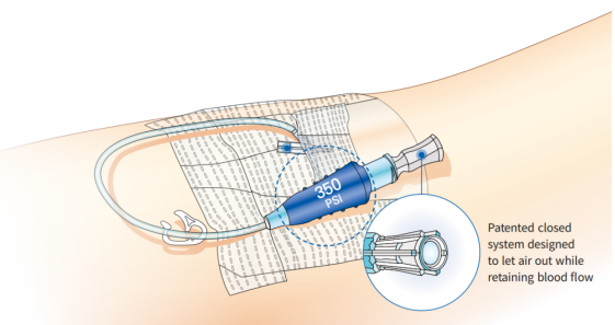 Antmed Pressjoni Għolja IV Catheter Introduzzjoni